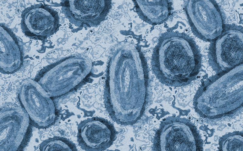 Imagen del virus del mono en laboratorio